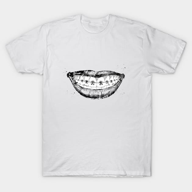 Teeth braces T-Shirt by erzebeth
